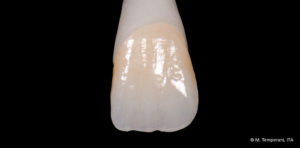 1063-ZirCAD_Prime_Ästhetik05