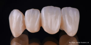 994-ZirCAD_Prime_Ästhetik03