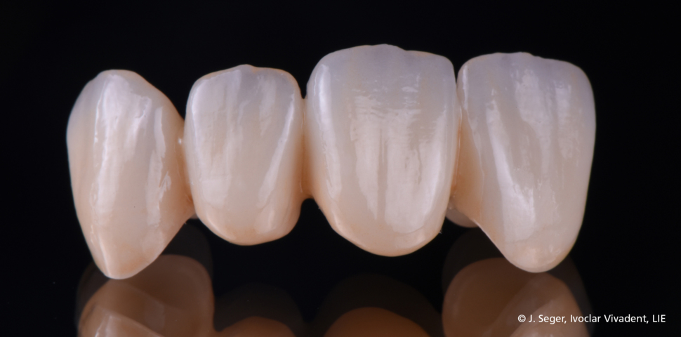 994-ZirCAD_Prime_Ästhetik03